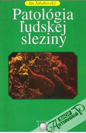 Patológia ľudskej sleziny - Jakubovský Ján
