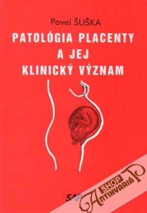 Patológia placenty a jej klinický význam - Šuška Pavel