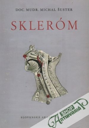 Skleróm - Šuster Michal
