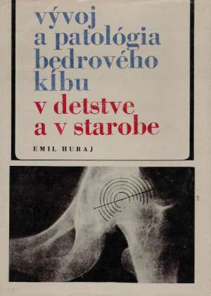 Vývoj a patológia bedrového kĺbu - Huraj Emil