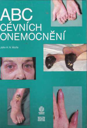 ABC CÉVNÍCH ONEMOCNĚNÍ - Wolfe J.H.N.