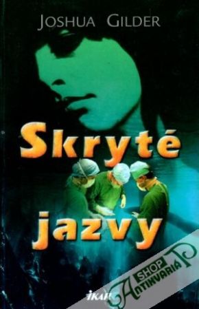 Skryté jazvy - Gilder Joshua
