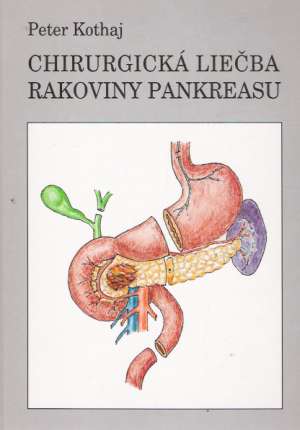 Chirurgická liečba rakoviny pankreasu - Kothaj Peter