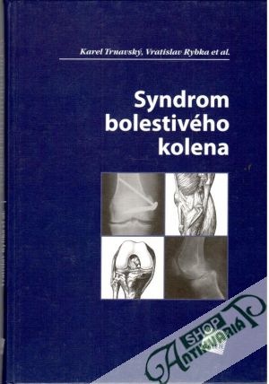 Syndrom bolestivého kolena - Trnavský Karel, Rybka Vratislav