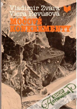 Močové konkrementy - Zvara Vladimír, Revúsová Viera