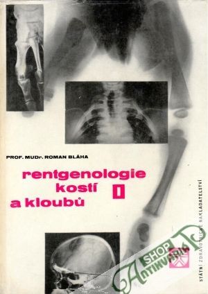 Rentgenologie kostí a kloubů (I. - II.) - Bláha Roman