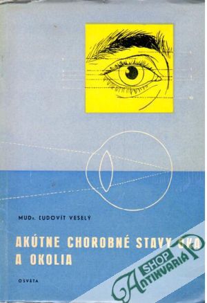 Akútne chorobné stavy oka a okolia - Veselý Ľudovít