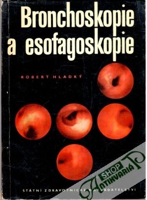 Bronchoskopie a esofagoskopie - Hladký Robert