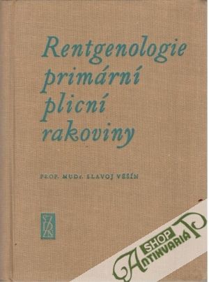 Rentgenologie primární plicní rakoviny - Věšín Slavoj