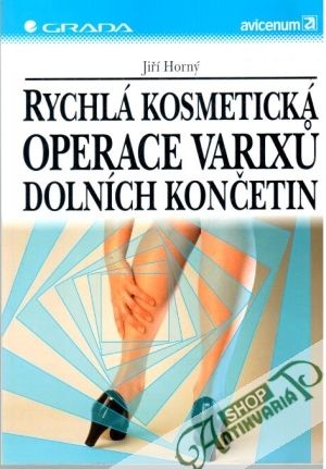 Rychlá kosmetická operace varixu dolních končetin - Horný Jiří