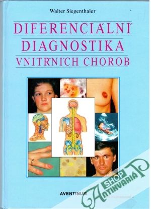 Diferenciální diagnostika vnitřních chorob - Siegenthaler Walter