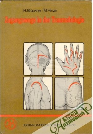 Zugangswege in der Traumatologie - Brückner H., Hinze M.
