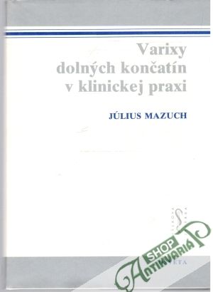 Varixy dolných končatín v klinickej praxi - Mazuch Július