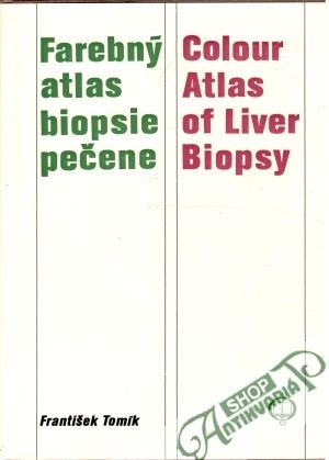 Farebný atlas biopsie pečene - Tomík František