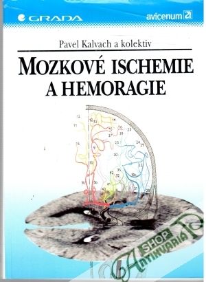 Mozkové ischemie a hemoragie - Kalvach Pavel a kolektív autorov