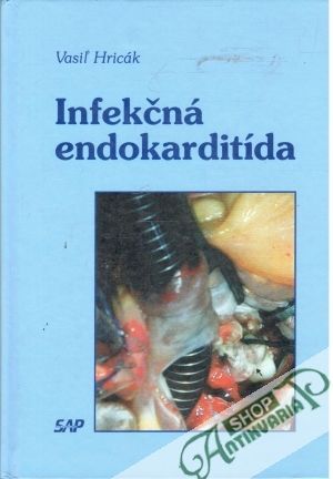 Infekčná endokarditída - Hricák Vasiľ