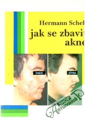 Jak se zbavit akné - Schell Hermann