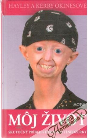Môj život - Okinesové Hayley a Kerry