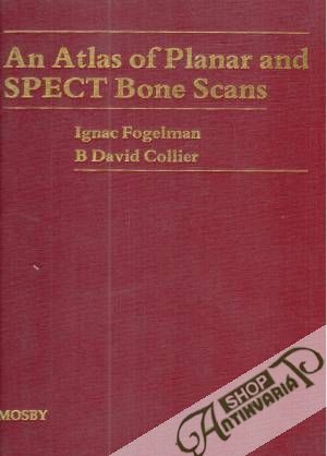 An atlas of planar and spect bone scans - Fogelman Ignac, Collier David
