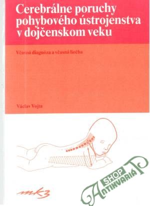 Cerebrálne poruchy pohybového ústrojenstva v dojčenskom veku - Vojta Václaav