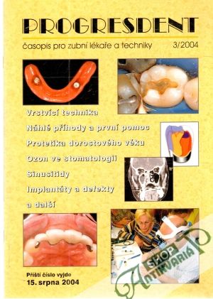 Progresdent 3/2004 - Kolektív autorov
