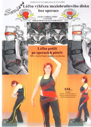Spirální stabilizace páteře - Smíšek a kolektív