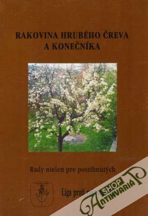 Rakovina hrubého čreva a konečníka - Kolektív autorov