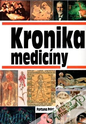 Kronika medicíny - kolektív autorov