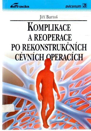 Komplikace a reoperace po rekonstrukčních cévních operacích - Bartoš Jiří