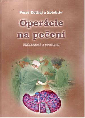 Operácie na pečeni - Kothaj Peter a kolektív