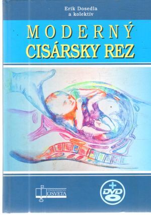 Moderný cisársky rez - bez DVD - Dosedla Erik a kolektív