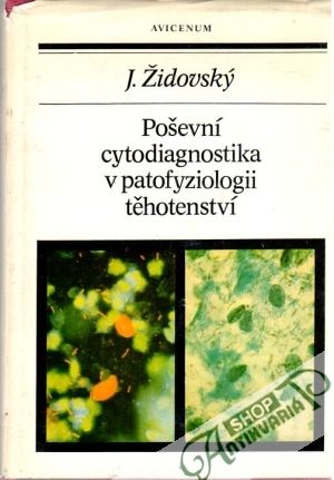 Poševní cytodiagnostika v patofyziologii těhotenství - Židovský Jan