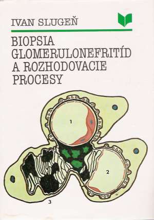 BIOPSIA GLOMERULONEFRITÍD A ROZHODOVACIE PROCESY - Slugeň Ivan