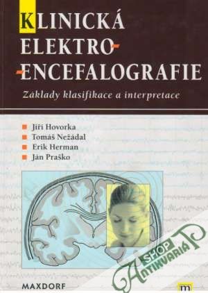 Klinická elektroencefalografie - Základy klasifikace a interpretace - Hovorka Jiří a kolektív